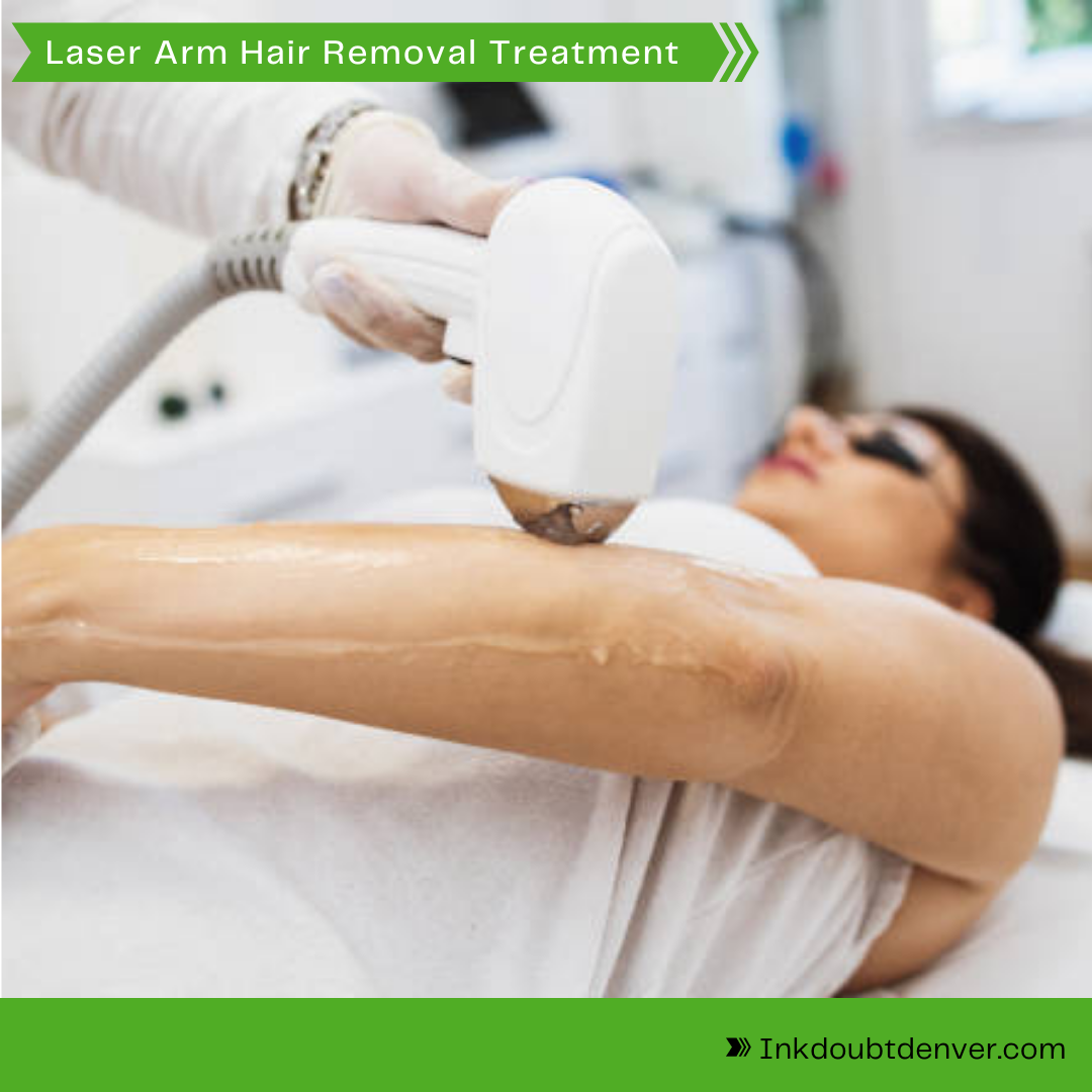 You are currently viewing LASER ARM HAIR REMOVAL TREATMENT | INK DOUBT DENVER